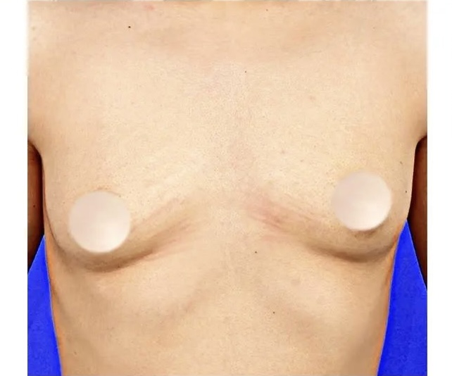 331359619_166850985689638_809600390506527677_n 3